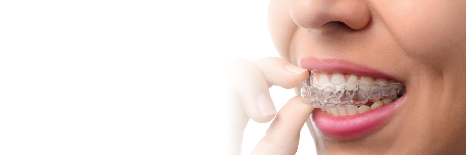 close up of woman using Invisalign